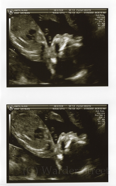 3rd Ultrasound 03.jpg